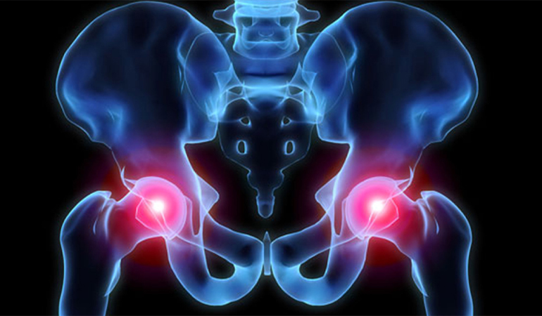 Kalça Hastalıkları